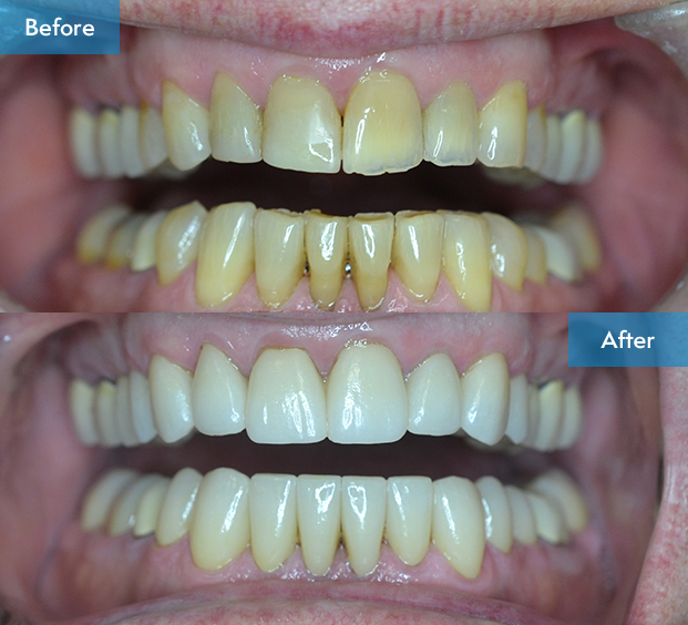 before after 3