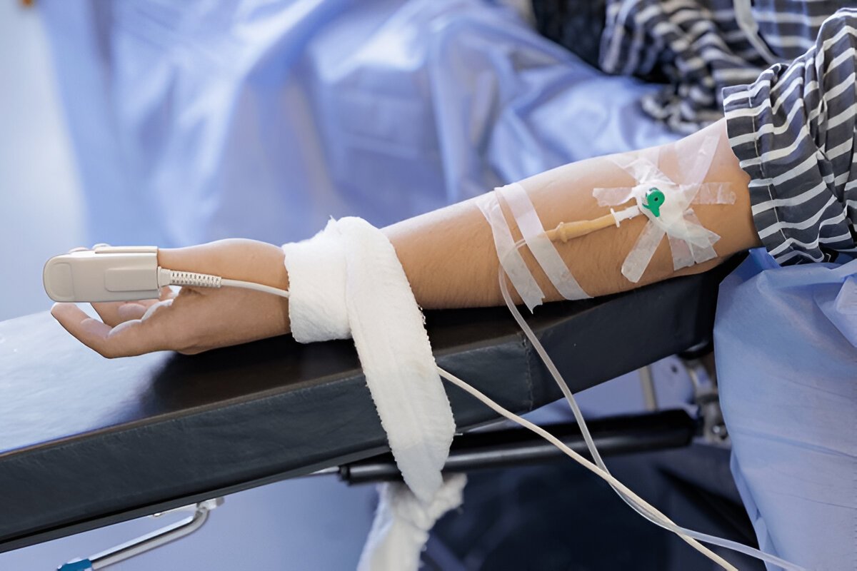 iv sedation near you