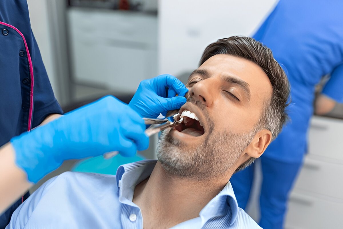 tooth extractions in downtown edmonton