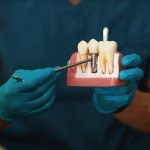 Dental Implants: What Patients Need to Know Before Their First Appointment