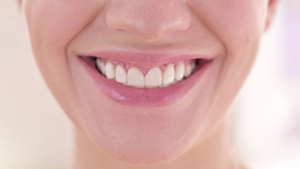 what-causes-white-spots-on-teeth-and-how-to-prevent-them