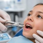 Tooth extraction explained procedure surgery and recovery